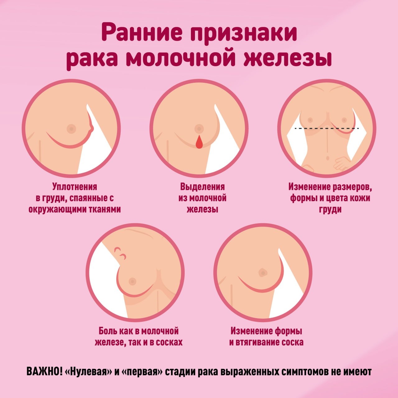 симптомы опухоли в груди у женщин фото 19